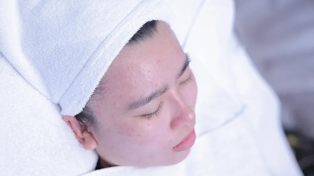 Nền da đỏ dấu hiệu cần can thiệp phục hồi