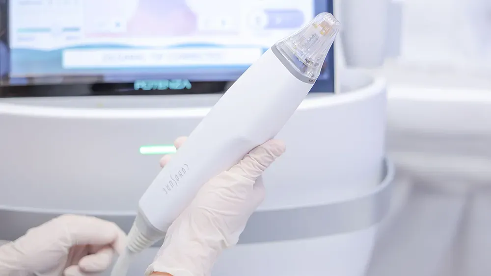 Potenza RF Microneedling dùng các vi kim siêu nhỏ tác động trực tiếp vào lớp trung bì