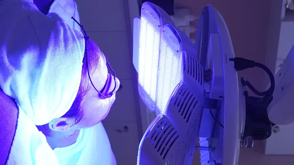 Ứng dụng ánh sáng xanh trong điều trị mụn viêm tại Minarie